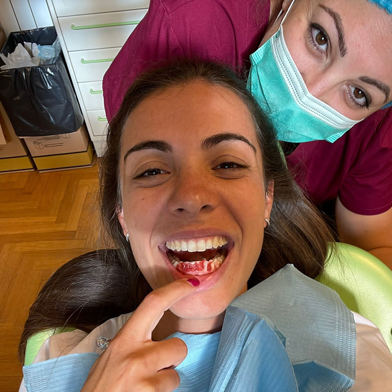 Sbiancamento Dentale Roma